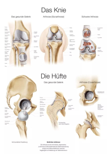 Uzskates materiāls - Celis 50x70cm